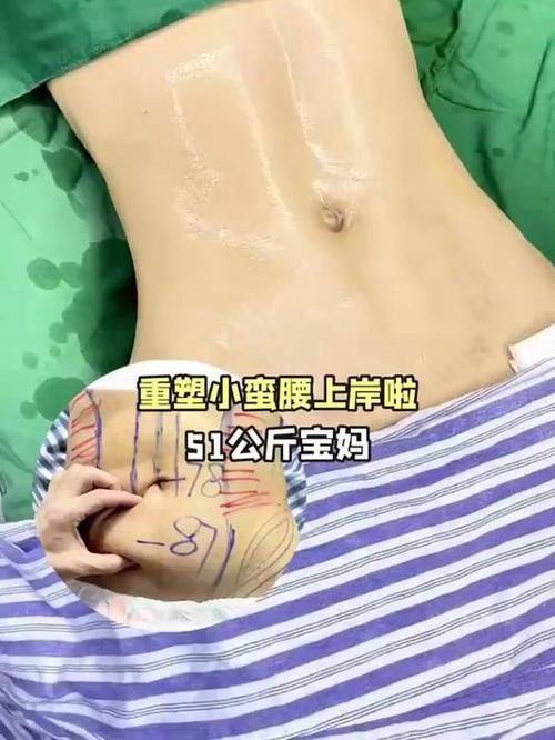 黄石市第五医院整形外科真人口碑评价怎么样?