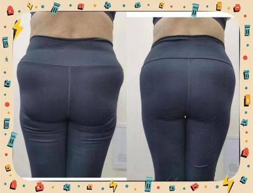 舟山伊美尔医疗美容医院收费价格表/收费标准