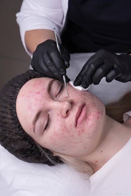 芜湖美人鱼医疗美容诊所详细的预约挂号方式及流程