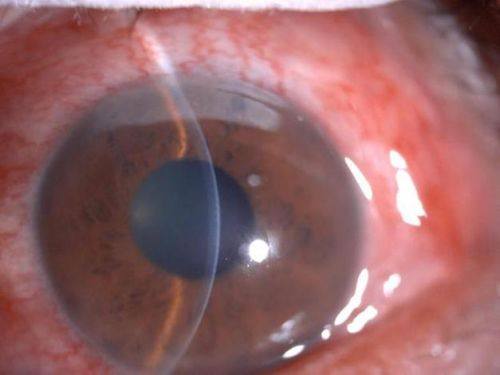 南充爱尔麦格眼科医院地址电话营业时间