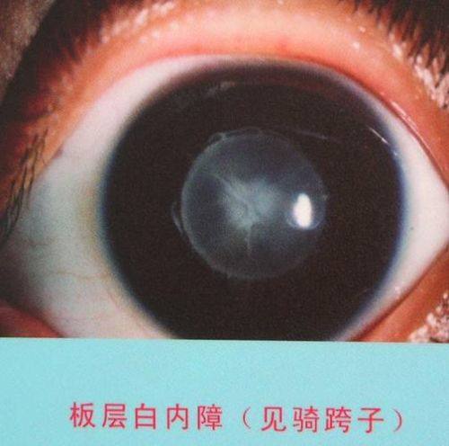 海城市中 心医院眼科收费价格表/收费标准