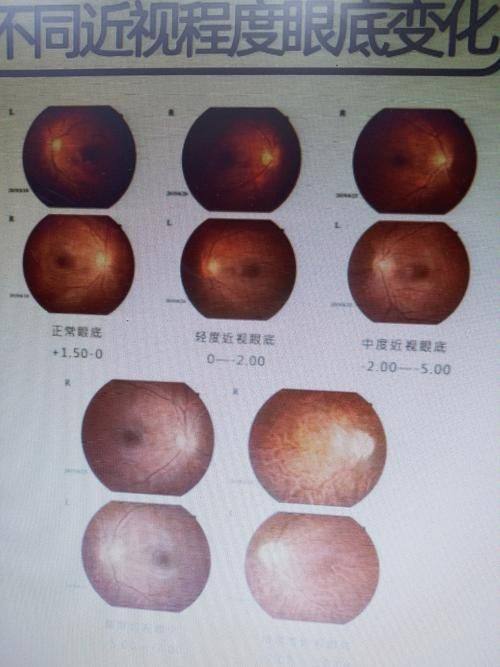 南充爱尔麦格眼科医院是正规医院吗?