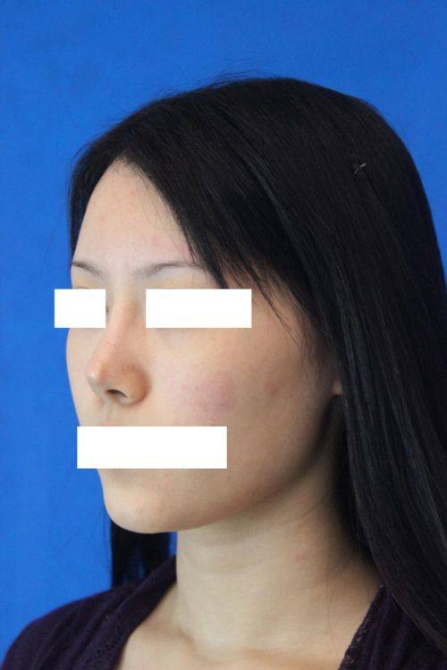 黄石市第五医院整形外科详细的预约挂号方式及流程