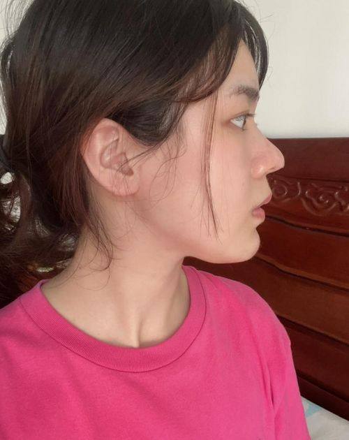 昆明华连众美整形医疗美容门诊部详细的预约挂号方式及流程