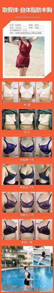 舟山伊美尔医疗美容医院真人口碑评价怎么样?