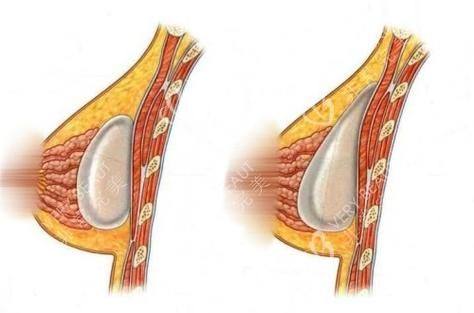 黄石市第五医院整形外科医生团队实力强大及骨干医生简介