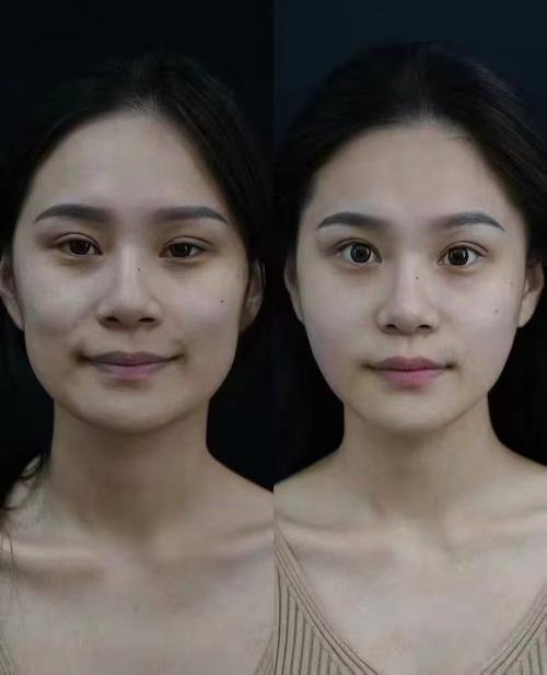 韩国清潭高云世上皮肤科是正规医院吗？