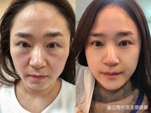 韩国清潭高云世上皮肤科真人口碑评价怎么样？