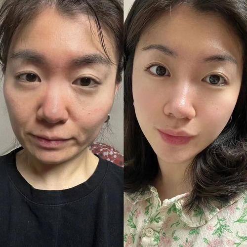 韩国清潭高云世上皮肤科详细的预约挂号方式及流程