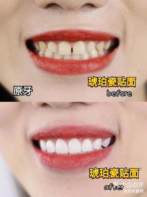 洛阳拜博口腔（景华路拜尔口腔门诊部）特色项目及技术优势