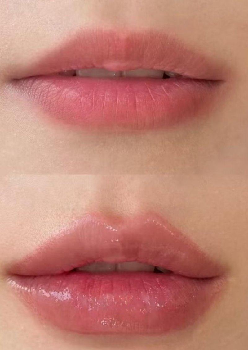 黄石市第五医院整形外科特色项目及技术优势