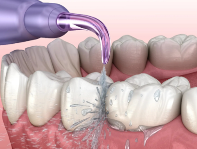 深圳欧卡多口腔门诊部是正规医院吗？