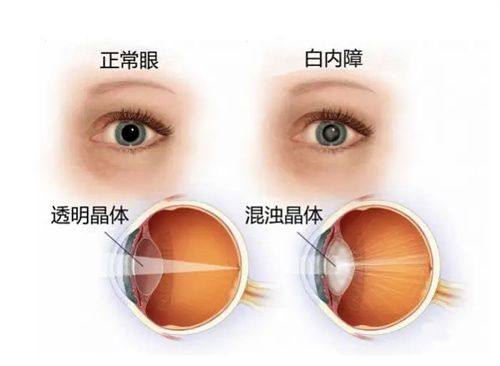 杭州师范大学附属医院眼科真人口碑评价怎么样？