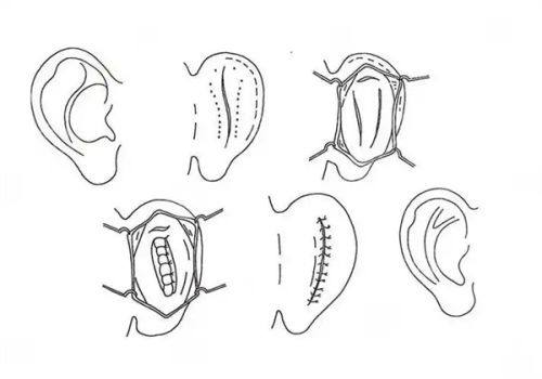 舒兰林树堂医疗美容诊所详细的预约挂号方式及流程