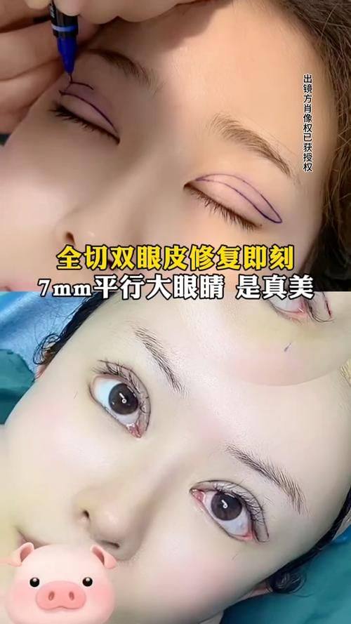 瑞安市人民医院整形外科真人口碑评价怎么样？