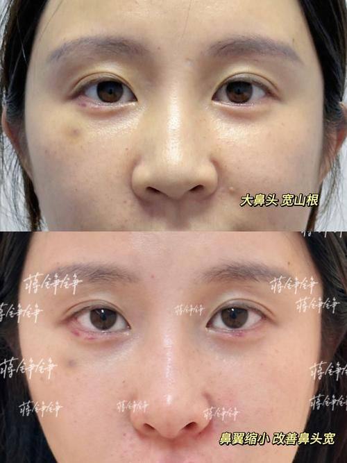 来宾颜白玉医疗美容门诊部详细的预约挂号方式及流程