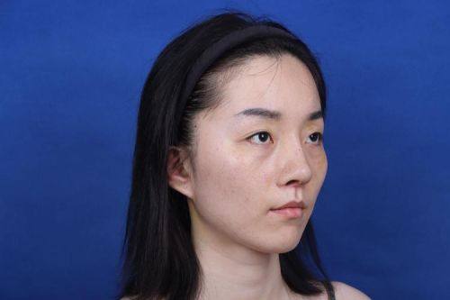 瑞安市人民医院整形外科医生团队实力强大及骨干医生简介