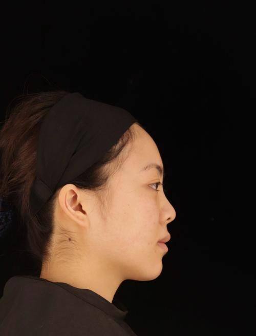 瑞安市人民医院整形外科收费价格表/收费标准