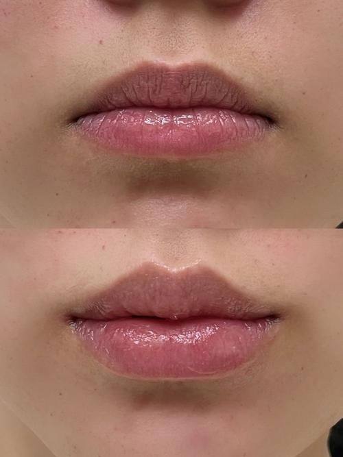 瑞安市人民医院整形外科特色项目及技术优势