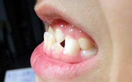 重庆黔江区周光琴口腔真人口碑评价怎么样？