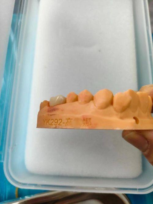 重庆黔江区周光琴口腔特色项目及技术优势