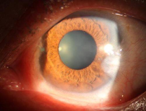 杭州师范大学附属医院眼科地址电话营业时间