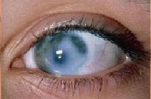 杭州师范大学附属医院眼科详细的预约挂号方式及流程