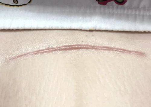 舒兰林树堂医疗美容诊所真人口碑评价怎么样？