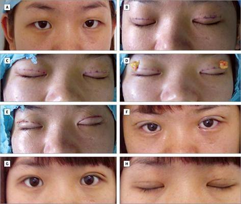 贵阳奥黛丽整形医院地址电话营业时间