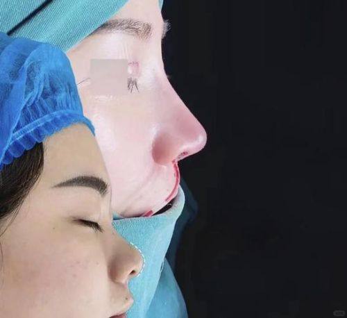 瑞安市人民医院整形外科是正规医院吗？