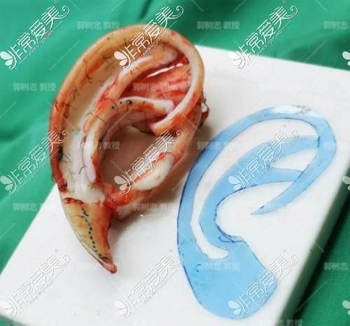 贵阳奥黛丽整形医院特色项目及技术优势