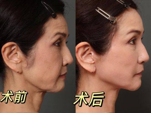 舒兰林树堂医疗美容诊所特色项目及技术优势