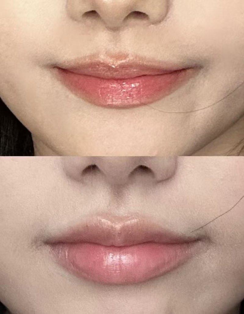 贵阳奥黛丽整形医院收费价格表/收费标准