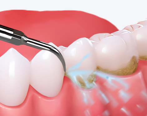 山东招远市蔚来口腔连锁详细的预约挂号方式及流程