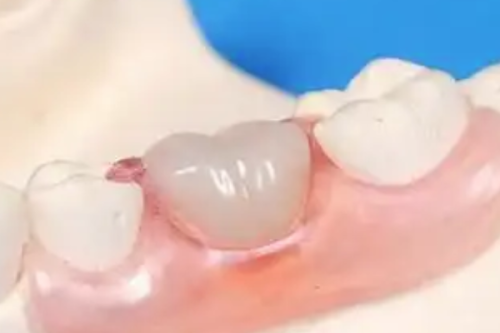 温州雅乐口腔是正规医院吗？