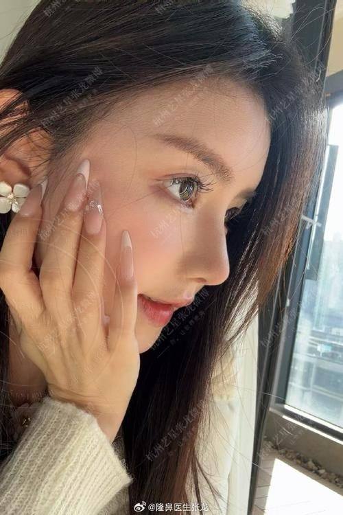 无锡艾谜整形医院真人口碑评价怎么样？