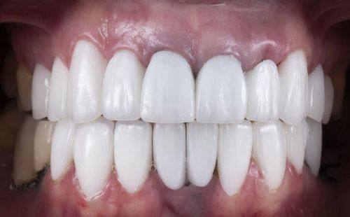 广西诺贝尔口腔门诊部特色项目及技术优势