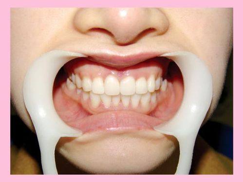 温州雅乐口腔收费价格表/收费标准