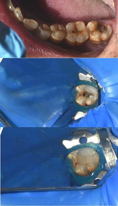 广东深圳陶敏口腔特色项目及技术优势