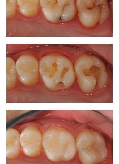 广东深圳陶敏口腔收费价格表/收费标准