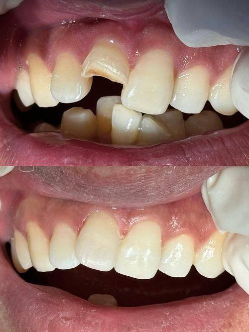 郴州市迅美口腔是正规医院吗？