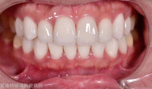 广西诺贝尔口腔门诊部地址电话营业时间