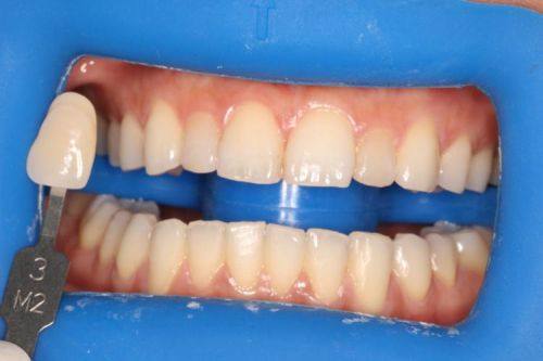 广西诺贝尔口腔门诊部是正规医院吗？