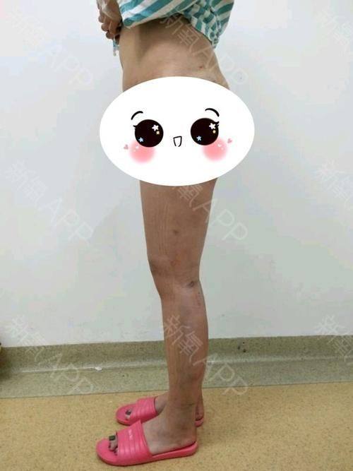 韩国施丽美羕医院（明洞店）特色项目及技术优势