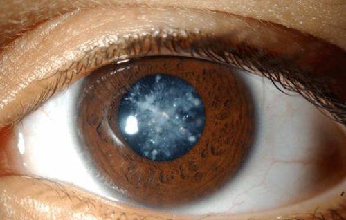 成都市公共卫生临床医疗中 心眼科地址电话营业时间