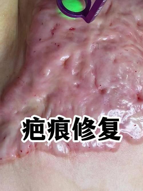 绍兴市妇幼保健院医疗美容科医生团队实力强大及骨干医生简介