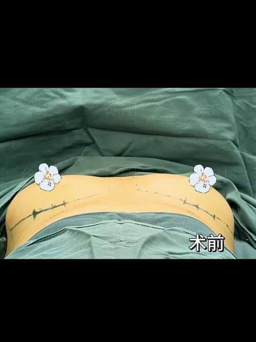 运城致美整形医院收费价格表/收费标准