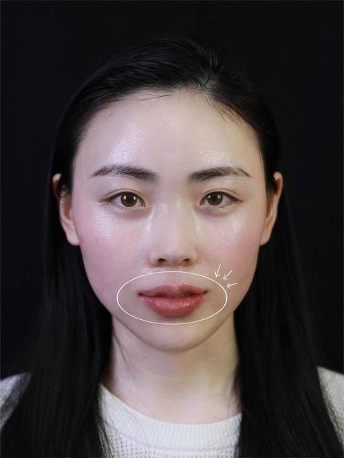 无锡艾谜整形医院是正规医院吗？