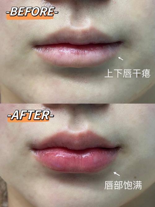 无锡艾谜整形医院地址电话营业时间