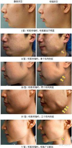 运城致美整形医院地址电话营业时间